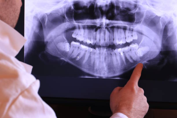 Best After-Hours Emergency Dentist in Ivey, GA