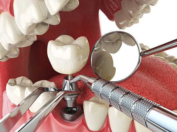 Best Same-Day Emergency Dentist in Ivey, GA